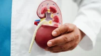 Angiomyolipoma
