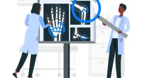 Bone cancer