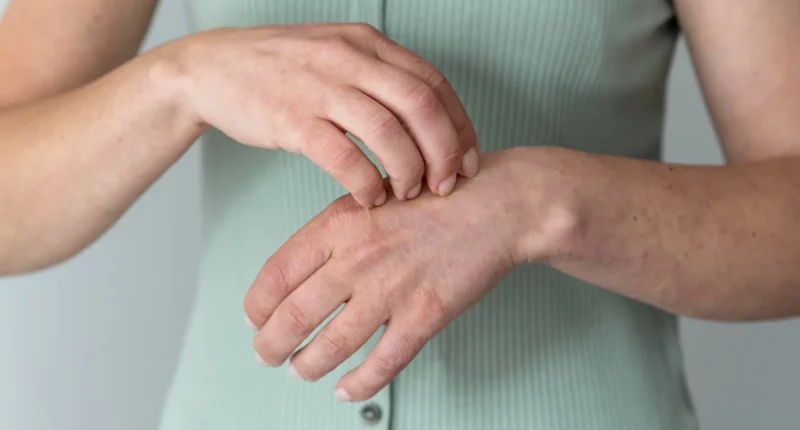 Fungal infections