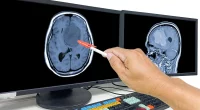 Brain