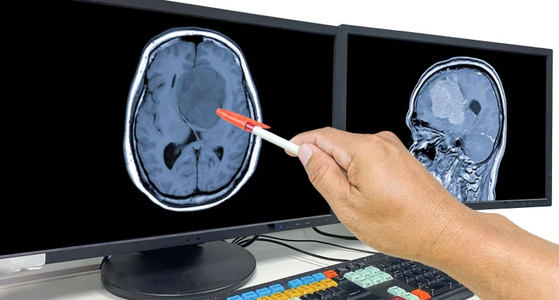 Brain