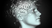 brain aneurysm