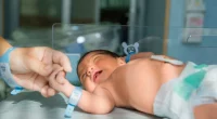 Bronchopulmonary dysplasia